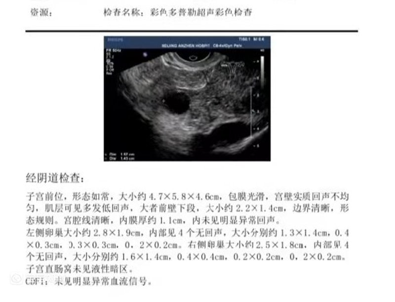 试管婴儿技术,让生育不再遥不可及。